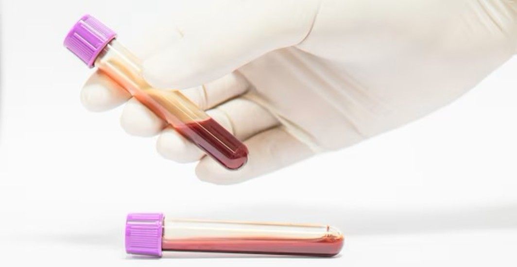 How to increase wbc count causes effective solutions